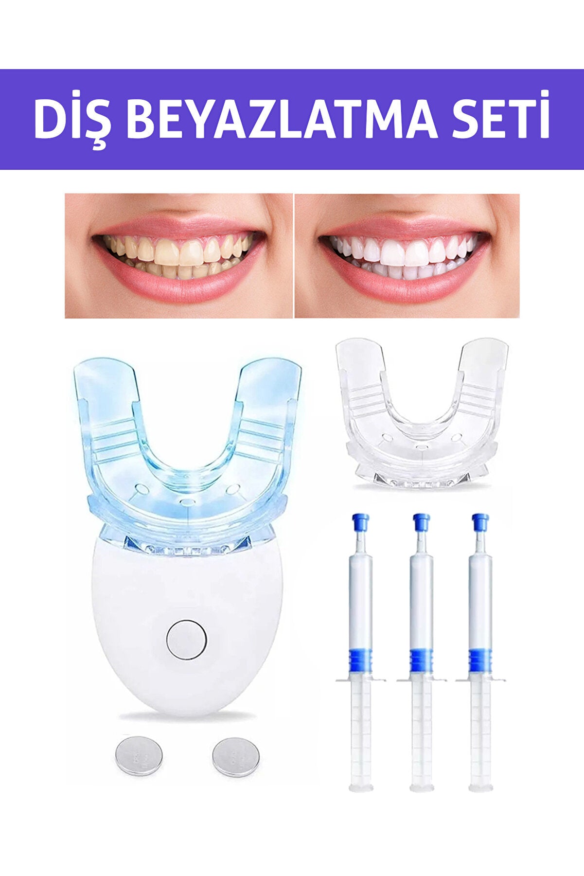 Diş Beyazlatma Seti , Diş Beyazlatıcı Kit